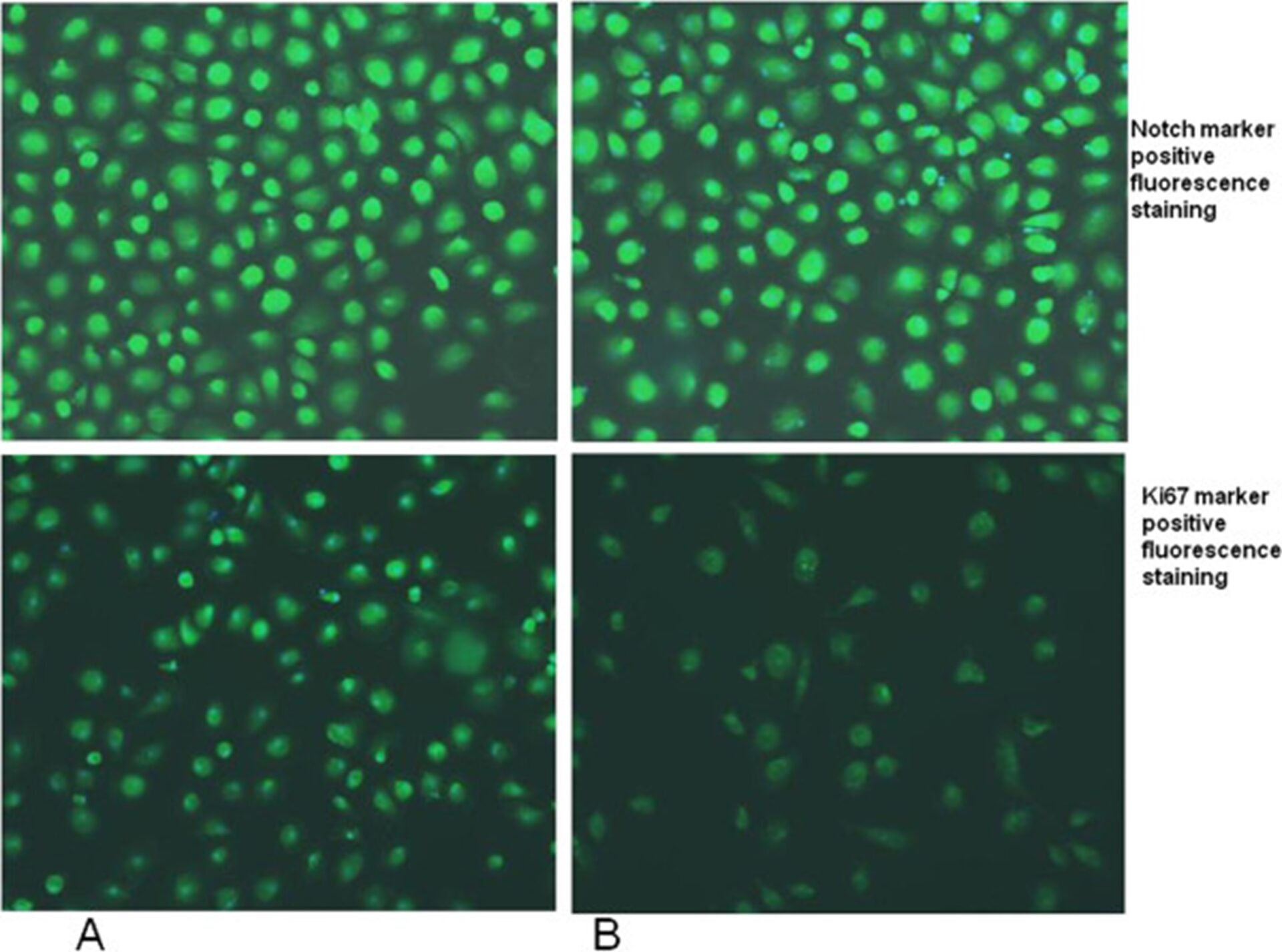 Влияние in vitro GcMAF на транскрипциономику эндоканнабиноидной системы, формирование рецепторов и клеточную активность макрофагов аутистического происхождения