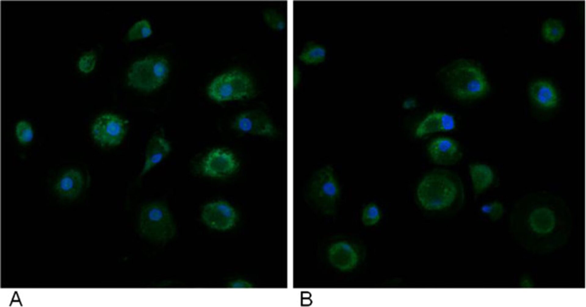 Влияние in vitro GcMAF на транскрипциономику эндоканнабиноидной системы, формирование рецепторов и клеточную активность макрофагов аутистического происхождения